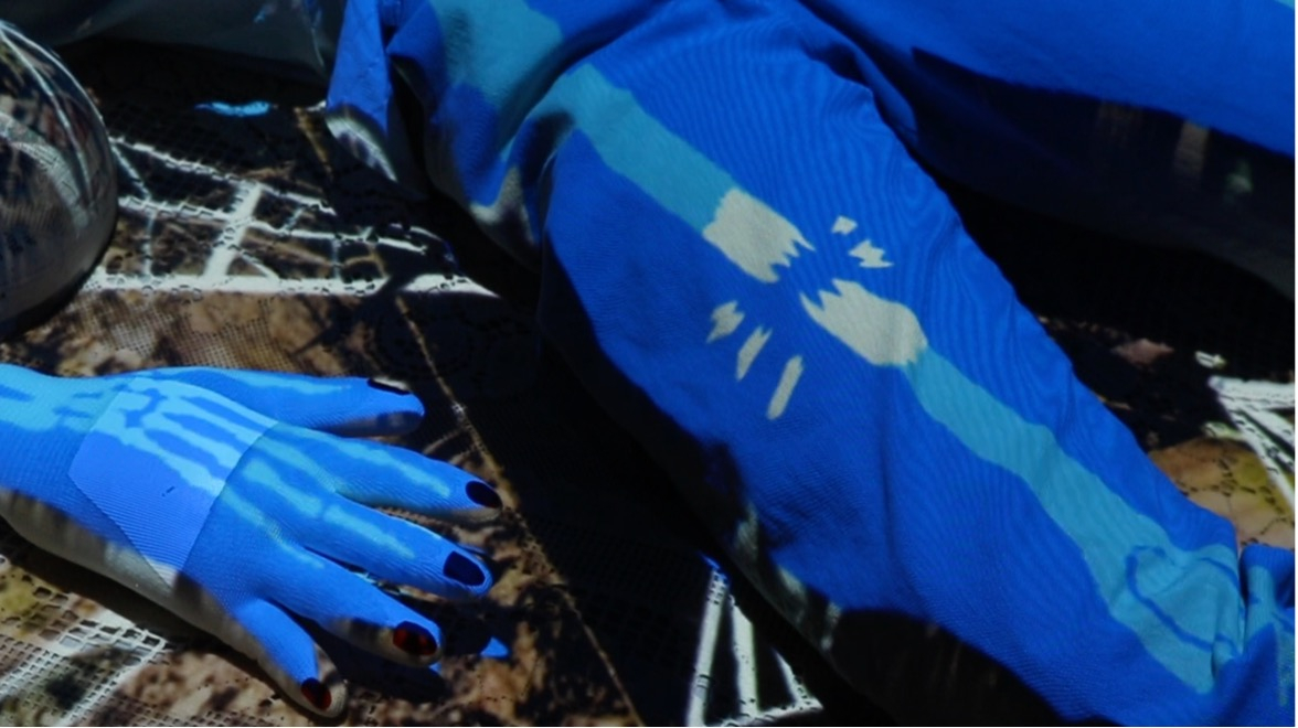 Still of 'Broken Femur'